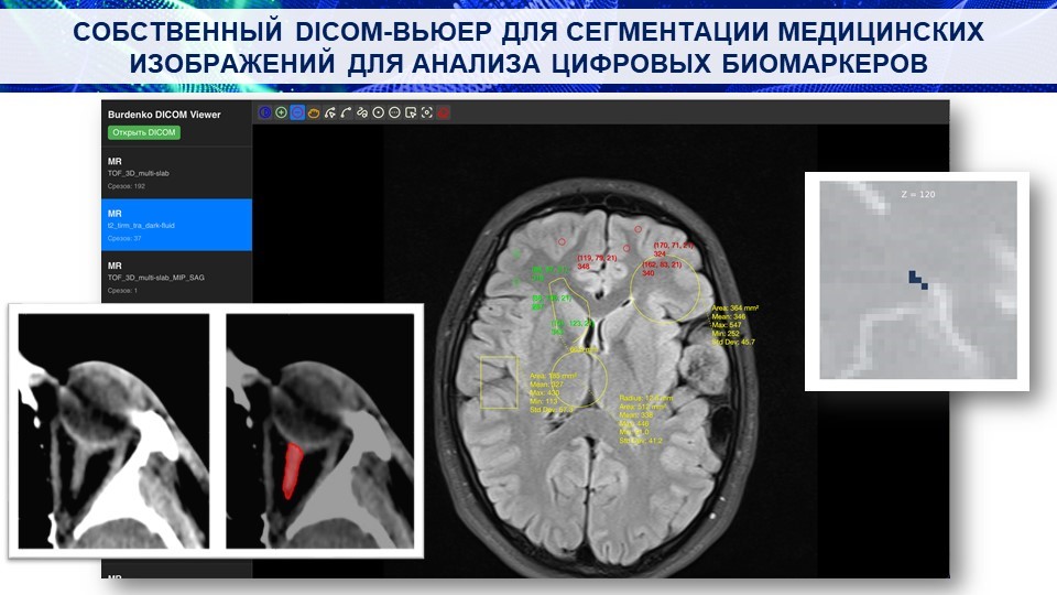 Рисунок 2. – Собственный веб-просмотрщик изображений в формате DICOM с технологиями искусственного интеллекта