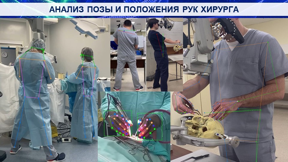 Рисунок 1. – Детекция позы и положения рук нейрохирурга с помощью моделей компьютерного зрения